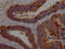 Galectin 3 antibody, CSB-RA970289A0HU, Cusabio, Immunohistochemistry paraffin image 