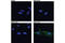 Neurotrophic Receptor Tyrosine Kinase 3 antibody, 3376S, Cell Signaling Technology, Immunocytochemistry image 