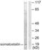 Somatostatin antibody, LS-B7046, Lifespan Biosciences, Western Blot image 