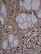 Fibronectin 1 antibody, ab23750, Abcam, Immunohistochemistry paraffin image 