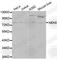 NIMA Related Kinase 8 antibody, A0984, ABclonal Technology, Western Blot image 