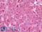 Beta-2-Microglobulin antibody, LS-B10120, Lifespan Biosciences, Immunohistochemistry paraffin image 