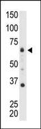 Myotubularin Related Protein 8 antibody, PA5-13714, Invitrogen Antibodies, Western Blot image 