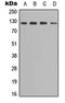 Sterol Regulatory Element Binding Transcription Factor 1 antibody, LS-C368524, Lifespan Biosciences, Western Blot image 