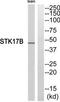 Serine/threonine-protein kinase 17B antibody, TA312139, Origene, Western Blot image 