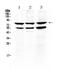 TNF Receptor Superfamily Member 11a antibody, PA5-80144, Invitrogen Antibodies, Western Blot image 