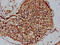 Proteasome 26S Subunit, Non-ATPase 4 antibody, CSB-PA018908HA01HU, Cusabio, Immunohistochemistry paraffin image 