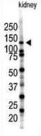 SUMO Specific Peptidase 7 antibody, abx026800, Abbexa, Western Blot image 