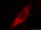 Galectin 3 antibody, 60207-1-Ig, Proteintech Group, Immunofluorescence image 