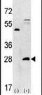 Proteasome Subunit Alpha 5 antibody, PA5-11509, Invitrogen Antibodies, Western Blot image 