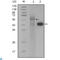 Pro-Apoptotic WT1 Regulator antibody, LS-C812826, Lifespan Biosciences, Immunohistochemistry paraffin image 