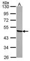 Kynureninase antibody, TA308219, Origene, Western Blot image 