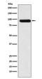 Activin A Receptor Type 2A antibody, M04770-1, Boster Biological Technology, Western Blot image 