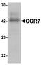 C-C Motif Chemokine Receptor 7 antibody, LS-C201180, Lifespan Biosciences, Western Blot image 