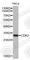 Cyclin Dependent Kinase 2 antibody, A2439, ABclonal Technology, Western Blot image 