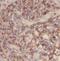 TCF3 Fusion Partner antibody, FNab08635, FineTest, Immunohistochemistry frozen image 