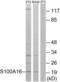 S100 Calcium Binding Protein A16 antibody, LS-C120269, Lifespan Biosciences, Western Blot image 