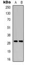 Regulating Synaptic Membrane Exocytosis 4 antibody, LS-C368765, Lifespan Biosciences, Western Blot image 