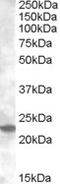 Ras-related protein Rab-17 antibody, LS-C112762, Lifespan Biosciences, Western Blot image 