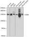 Damage Specific DNA Binding Protein 1 antibody, A2896, ABclonal Technology, Western Blot image 