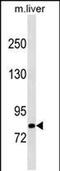 Cbl Proto-Oncogene B antibody, PA5-49172, Invitrogen Antibodies, Western Blot image 