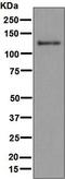 Interferon Induced With Helicase C Domain 1 antibody, ab126630, Abcam, Western Blot image 