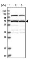 Zinc Finger And BTB Domain Containing 5 antibody, PA5-54437, Invitrogen Antibodies, Western Blot image 