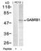 Gamma-Aminobutyric Acid Type B Receptor Subunit 1 antibody, orb14596, Biorbyt, Western Blot image 