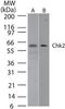 Checkpoint Kinase 2 antibody, TA336399, Origene, Western Blot image 