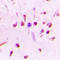Heat Shock Transcription Factor 1 antibody, LS-C356117, Lifespan Biosciences, Immunohistochemistry paraffin image 