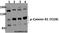 Catenin Delta 1 antibody, A02333Y228, Boster Biological Technology, Western Blot image 