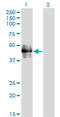 CD177 Molecule antibody, LS-B5469, Lifespan Biosciences, Western Blot image 