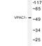 Vasoactive Intestinal Peptide Receptor 1 antibody, LS-C177415, Lifespan Biosciences, Western Blot image 