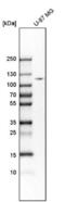 Hexokinase 2 antibody, NBP1-90922, Novus Biologicals, Western Blot image 