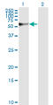 Stress Induced Phosphoprotein 1 antibody, LS-C133666, Lifespan Biosciences, Western Blot image 