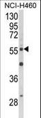 AKT Serine/Threonine Kinase 2 antibody, LS-C156234, Lifespan Biosciences, Western Blot image 
