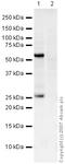 Recoverin antibody, ab31928, Abcam, Western Blot image 
