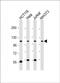 Pre-MRNA Processing Factor 6 antibody, PA5-72186, Invitrogen Antibodies, Western Blot image 