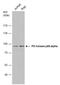 Phosphoinositide-3-Kinase Regulatory Subunit 1 antibody, GTX112994, GeneTex, Western Blot image 