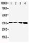 Protein C, Inactivator Of Coagulation Factors Va And VIIIa antibody, PA1682, Boster Biological Technology, Western Blot image 