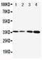 Vitamin K-dependent protein C antibody, PA1682, Boster Biological Technology, Western Blot image 