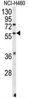 Estrogen Related Receptor Beta antibody, GTX80586, GeneTex, Western Blot image 