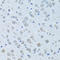 Kininogen 1 antibody, A02939, Boster Biological Technology, Western Blot image 