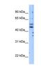 Phosphoinositide-3-Kinase Regulatory Subunit 3 antibody, NBP1-58332, Novus Biologicals, Western Blot image 
