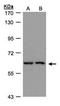 Fibroblast Growth Factor Receptor Substrate 2 antibody, PA5-27875, Invitrogen Antibodies, Western Blot image 