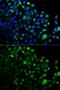 TNF Receptor Associated Factor 2 antibody, GTX16381, GeneTex, Immunofluorescence image 