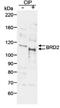 Bromodomain-containing protein 2 antibody, GTX19276, GeneTex, Western Blot image 