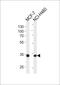 Tafazzin antibody, PA5-72579, Invitrogen Antibodies, Western Blot image 
