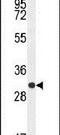 Cytotoxic T-Lymphocyte Associated Protein 4 antibody, PA5-23967, Invitrogen Antibodies, Western Blot image 