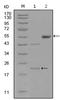 EPH Receptor A5 antibody, AM06295SU-N, Origene, Western Blot image 